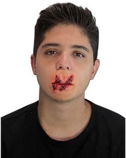 Cut Lips Appliance Kit